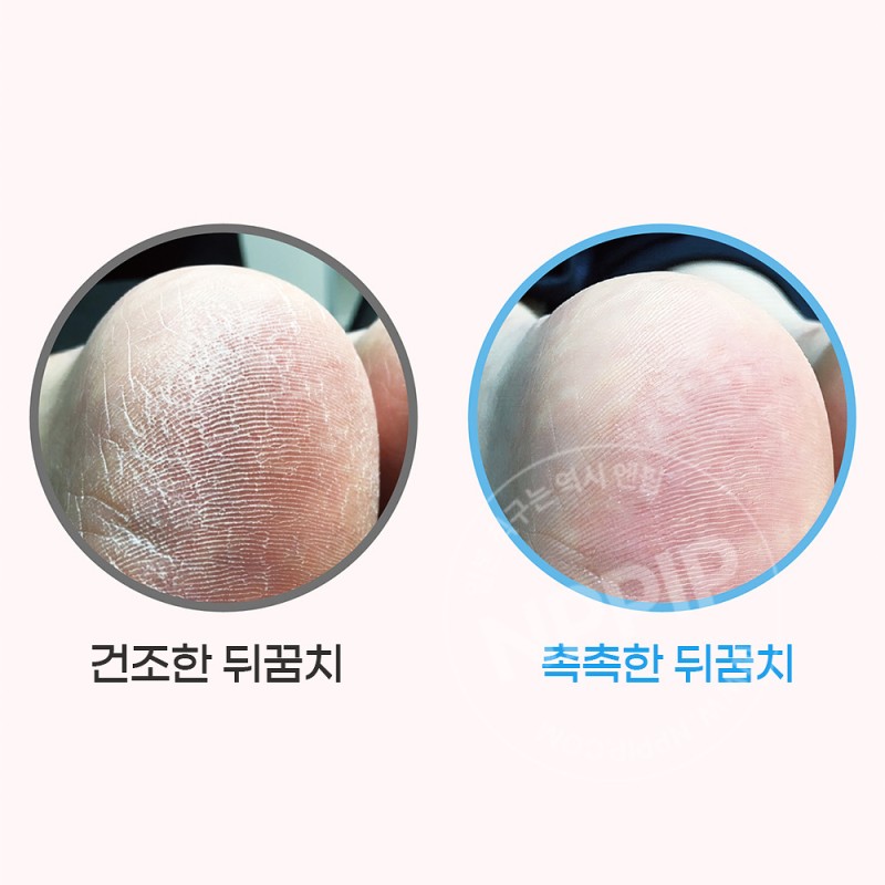 네이처콘크 약용 풋케어 로션 40ml 발뒤꿈치 갈라짐 각질제거 발보습 크림